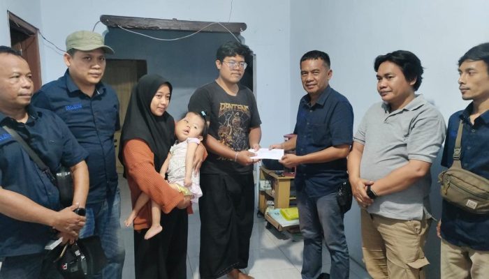 Pokja Jurnalis Kraksaan Tunjukkan Kepedulian, Santuni Balita Penderita Sindrom Langka di Probolinggo