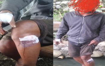 Insiden Berdarah di Purwokerto Timur: Pria di Mersi Ditusuk Tamu Tak di Undang di Rumah Sendiri
