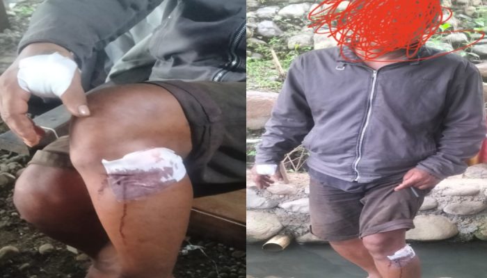 Insiden Berdarah di Purwokerto Timur: Pria di Mersi Ditusuk Tamu Tak di Undang di Rumah Sendiri